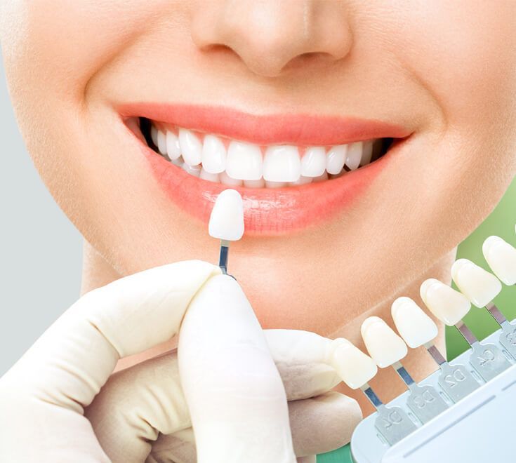 Best Cosmetic and Laser Dentistry in Amanora Park Town Hadapsar