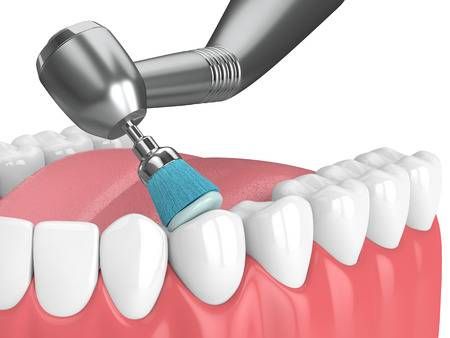 Best Teeth Cleaning and Polishing in Amanora Park Town Hadapsar